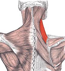 Rhomboideus Klachten